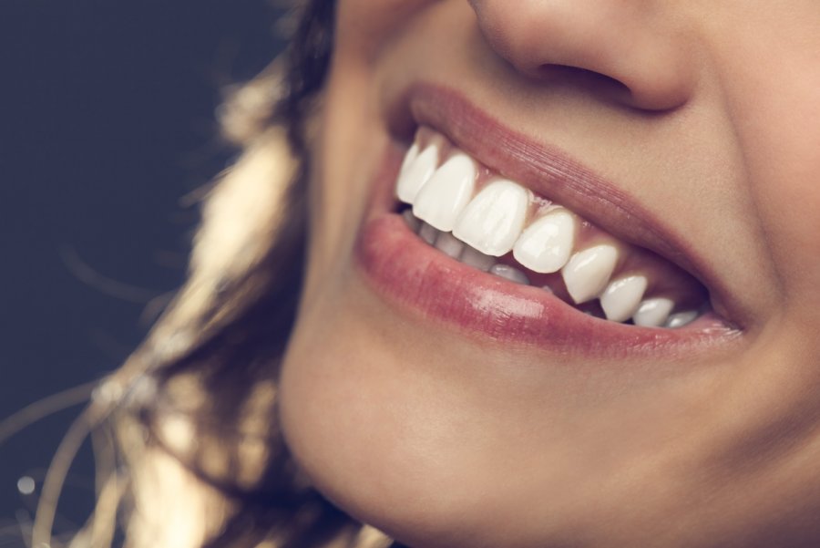 Dentální hygiena
